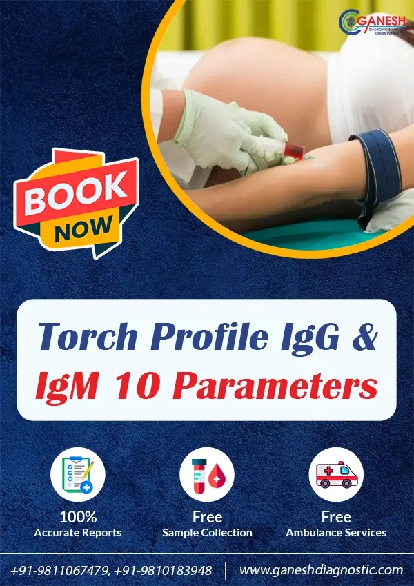 Torch Profile IgG and IgM 10 Parameters